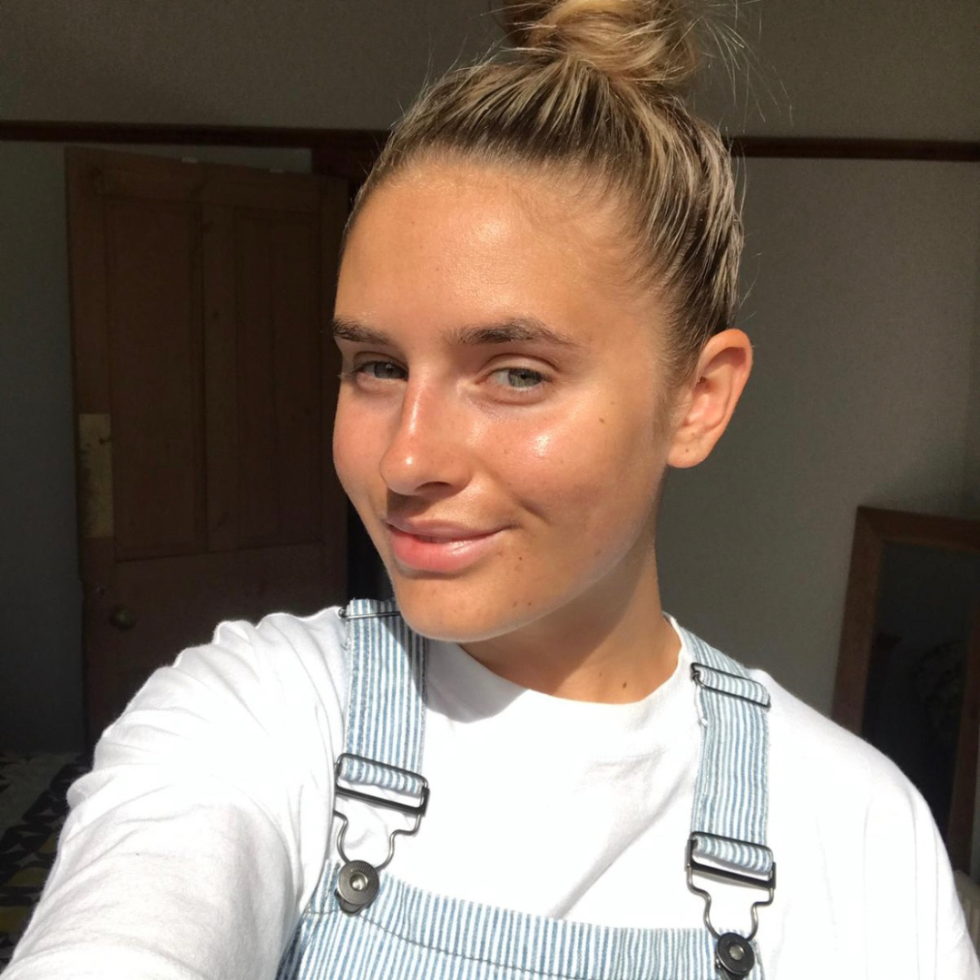 Founder of Heal Acne Naturally