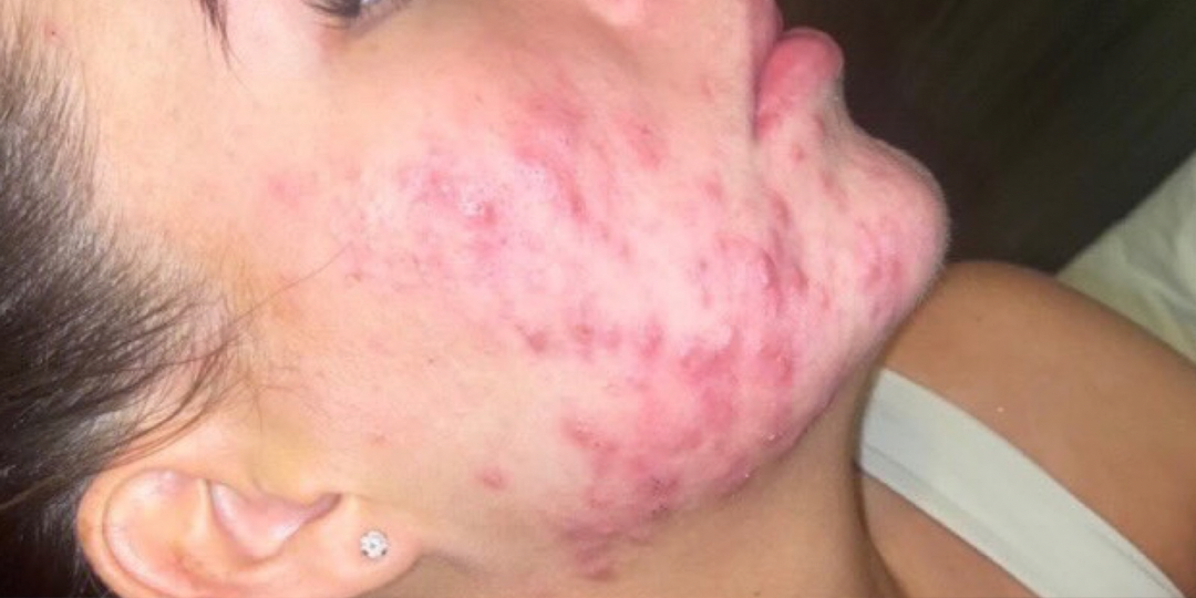 Before skin transformation