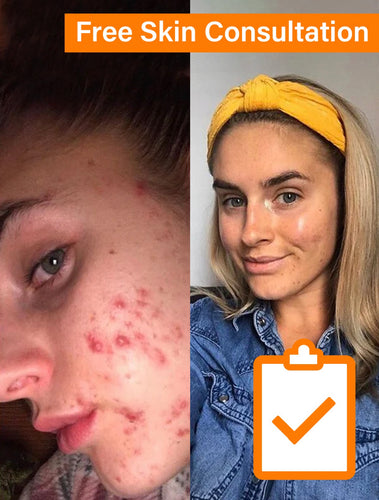 Free Skin Consultation - How To Achieve Results Like Mine!